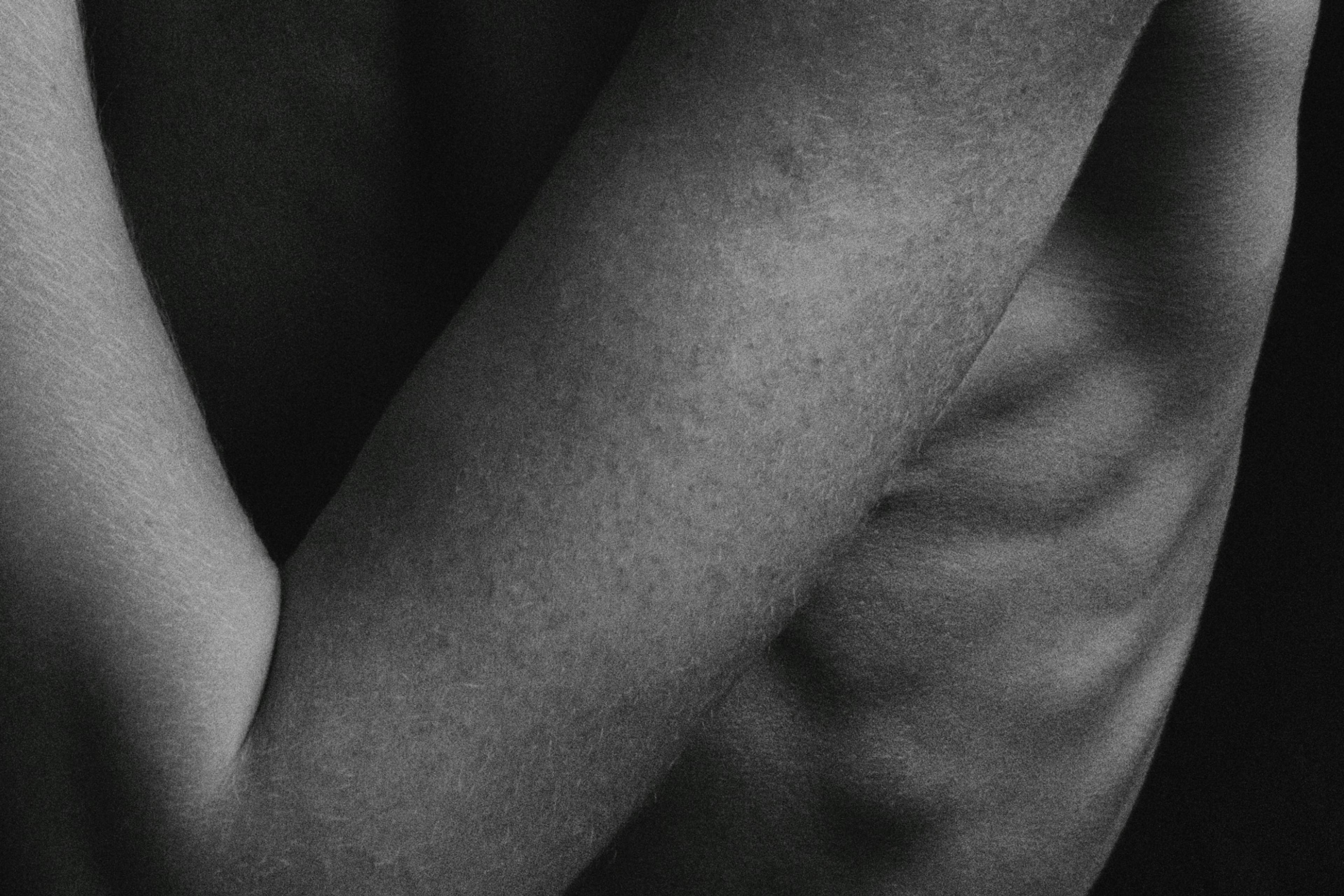 Black and white close-up photo of a person’s arm showing skin texture and pigment and shadows; protruding ribs are visible behind the arm.